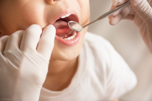 歯医者の定期健診は意味ない